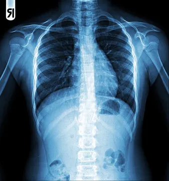 X-ray